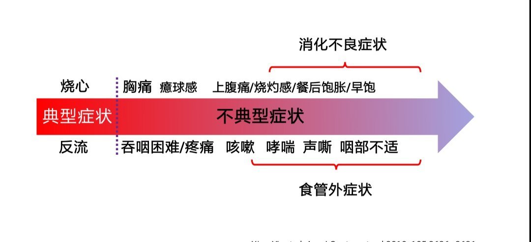 嗓子痛,乾咳怎麼會是胃食管反流病?——非典型症狀