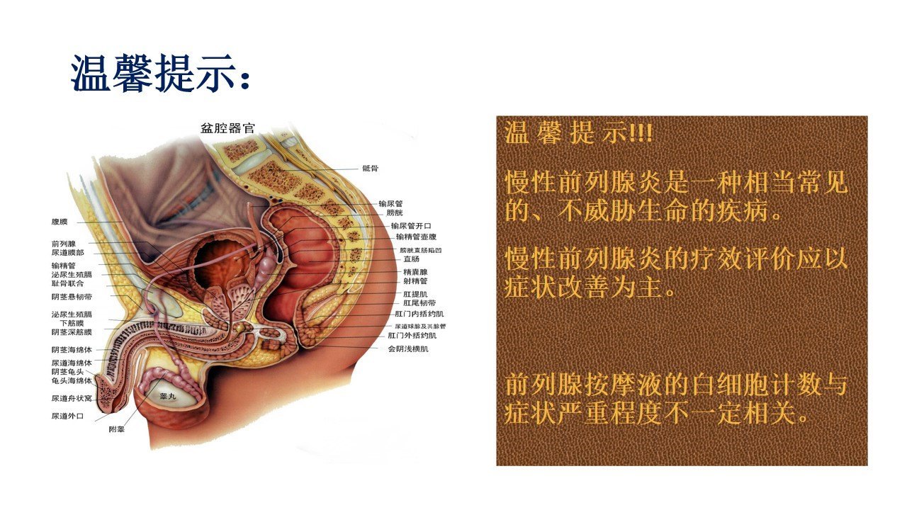 最有效最经济治疗前列腺炎方案选择张大夫良心推荐