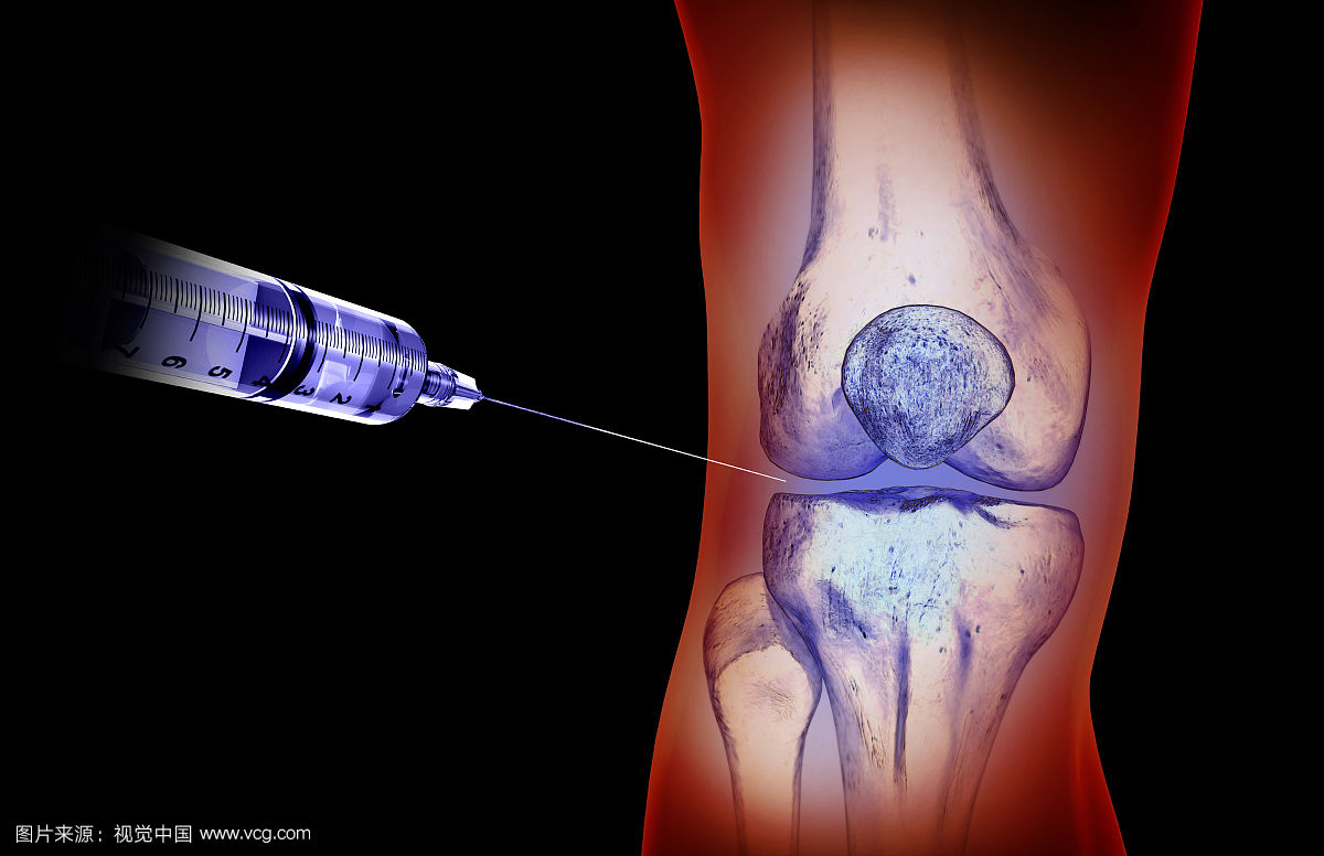 滑膜炎胶囊多久一个疗程_滑膜炎布洛芬缓释胶囊一天吃几次_滑膜炎胶囊的适应症