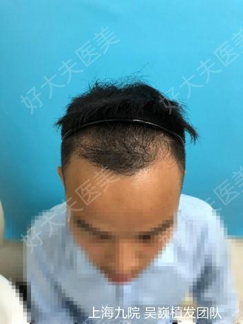 圖文圖片