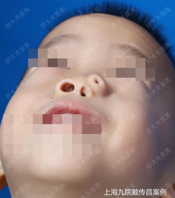 圖文圖片