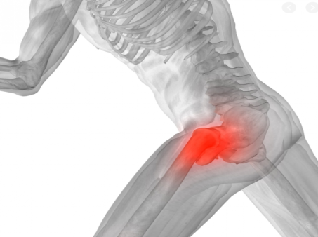 跑步造成髋关节疼痛的10个常见原因 关节痛
