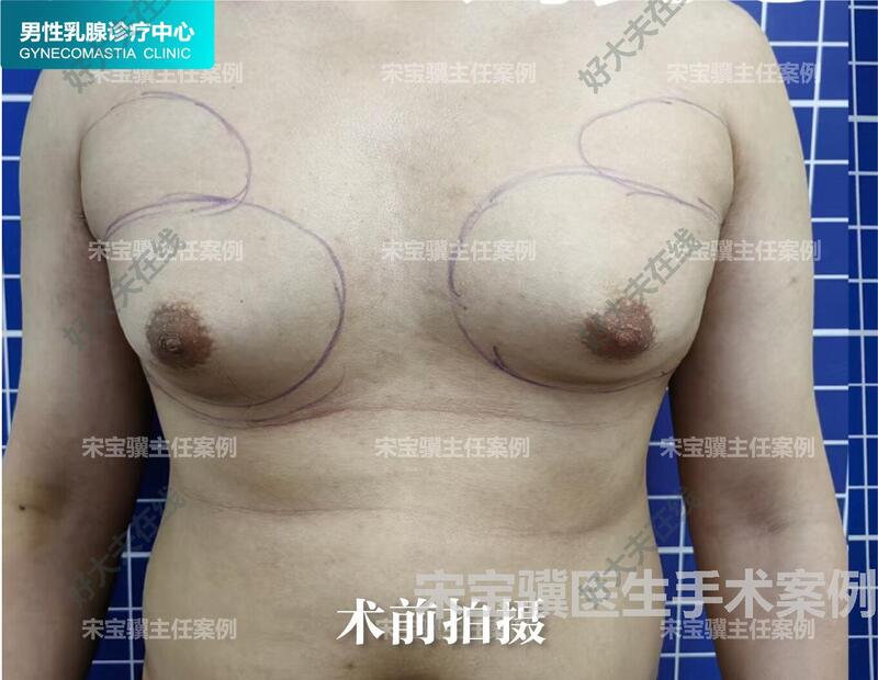 圖文圖片