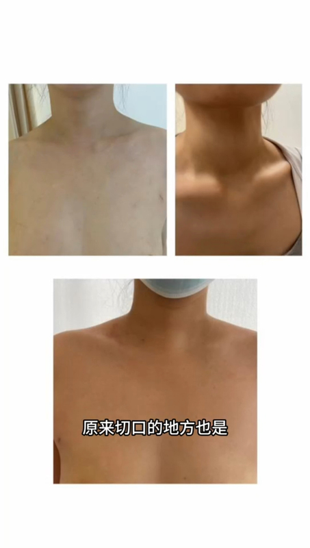 視頻封面