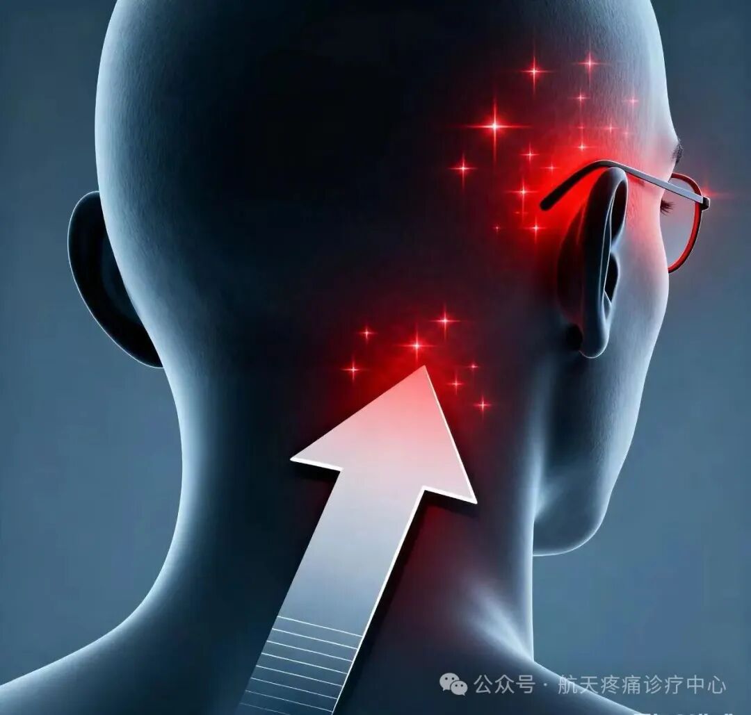 怎么能缓解颈源性头痛 SoFybJNuu68U77LJ4u001759879708.png?_ms_=5fae