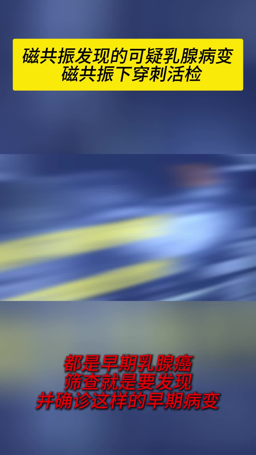 視頻封面