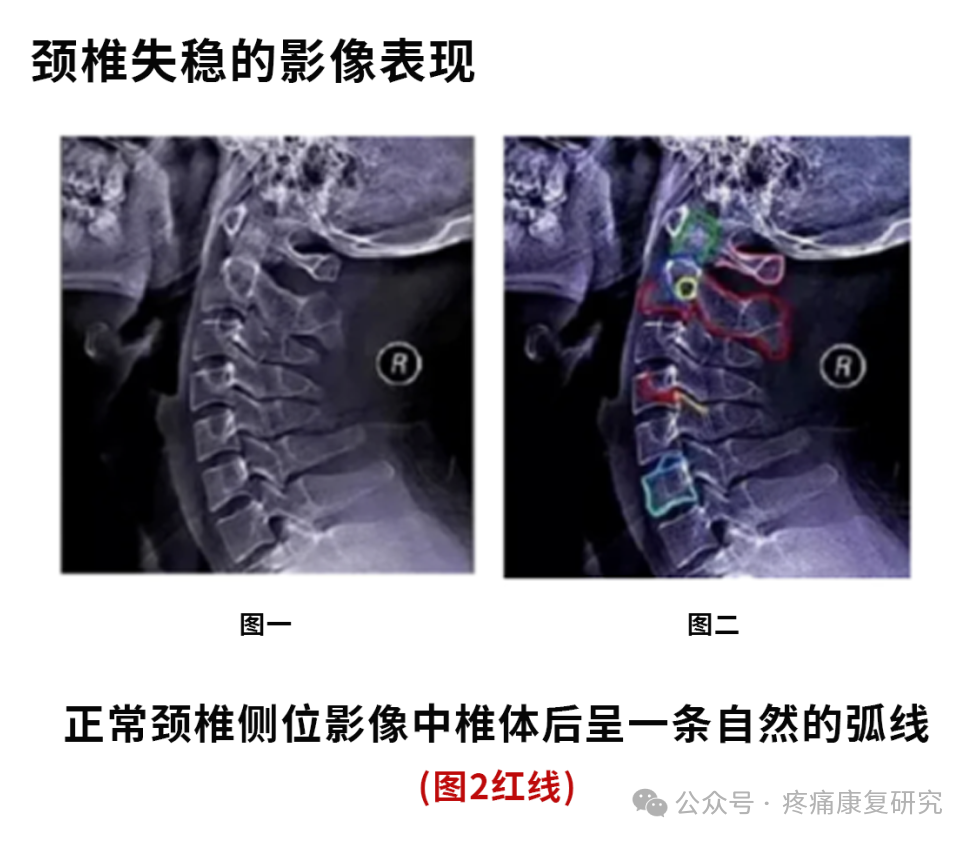 睡眠神经功能紊乱 Z6r0FIhW7K3M0LRxLZ001765180831.png?_ms_=8c1e