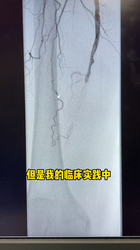 視頻封面