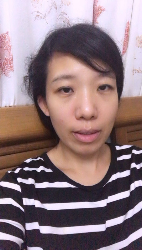 减胎对另一个胎儿有什么影响？