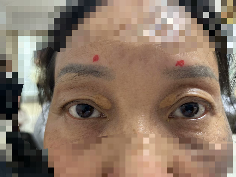 圖文圖片