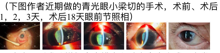 圖文圖片