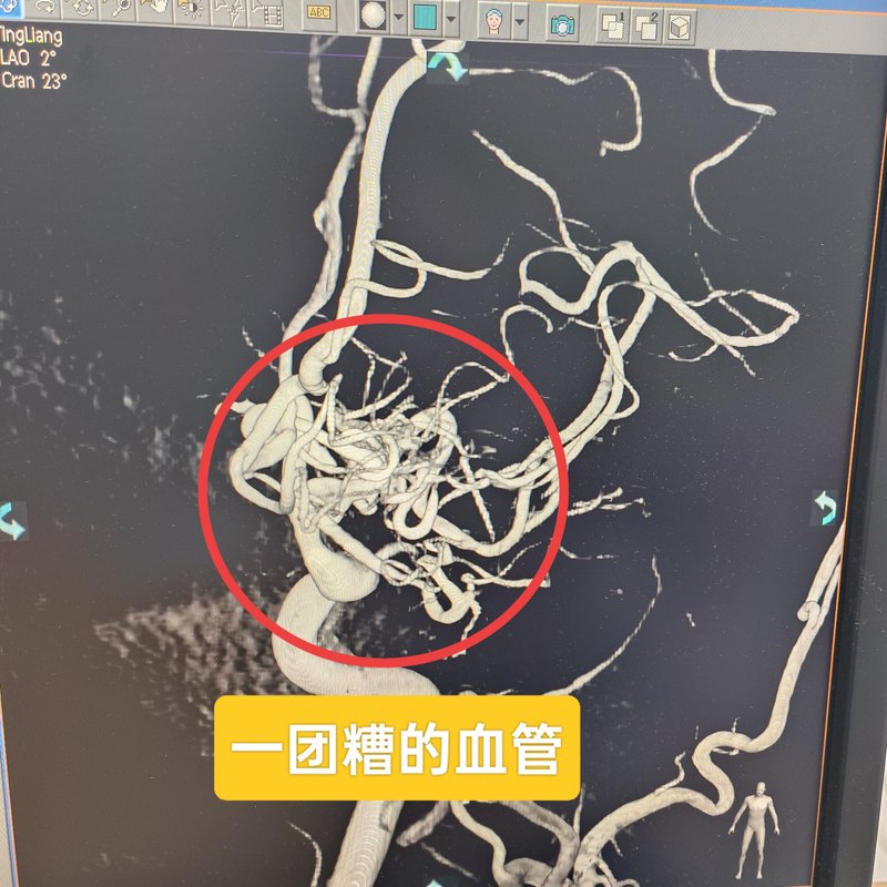 圖文圖片