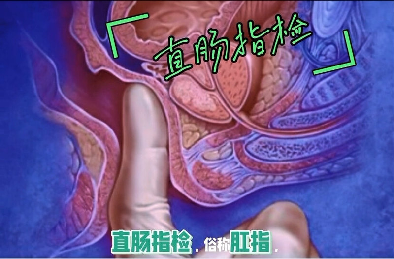 为什么说直肠指检这个“金手指”是诊断直肠癌和痔疮等疾病最不可或缺的手段？
