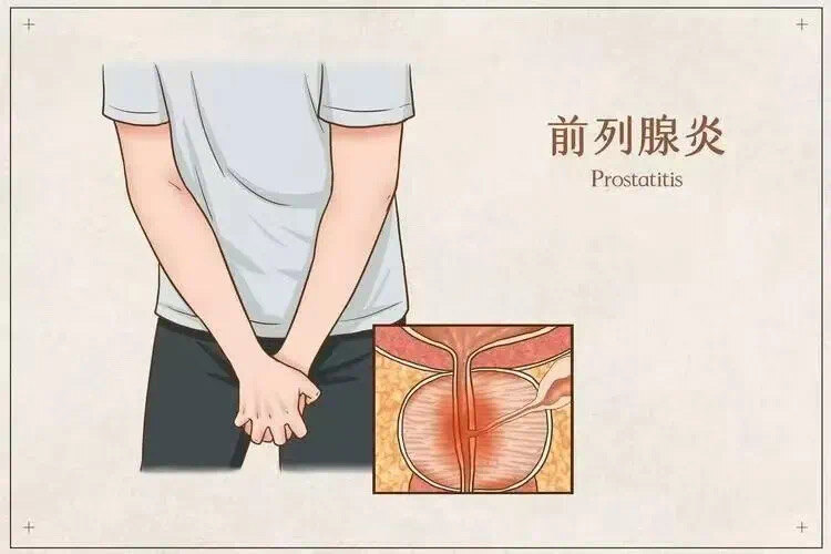 圖文圖片