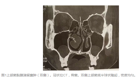圖文圖片