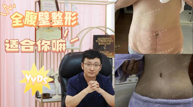 全腹壁整形你适合吗