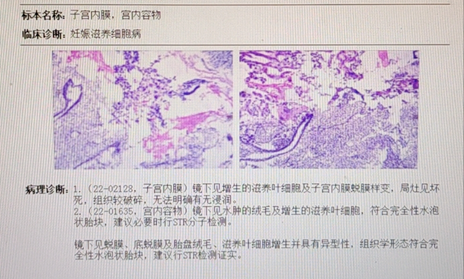 圖文圖片