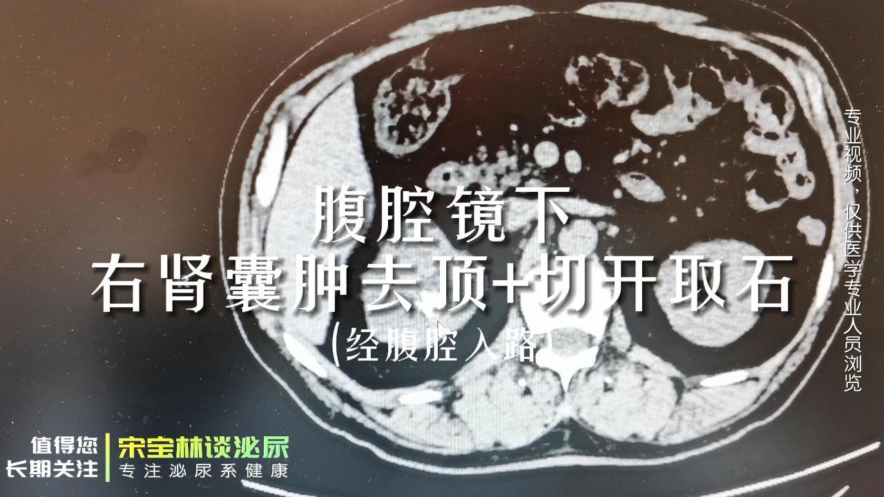圖文圖片