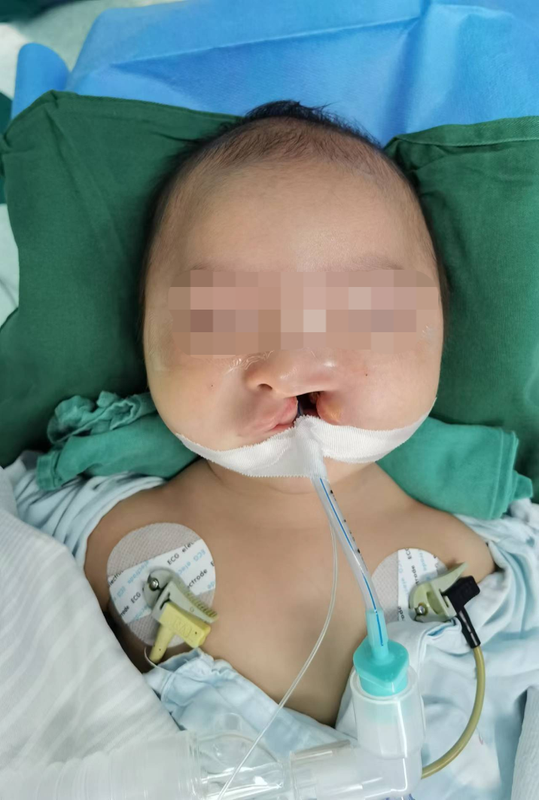 圖文圖片