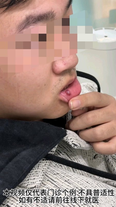 視頻封面