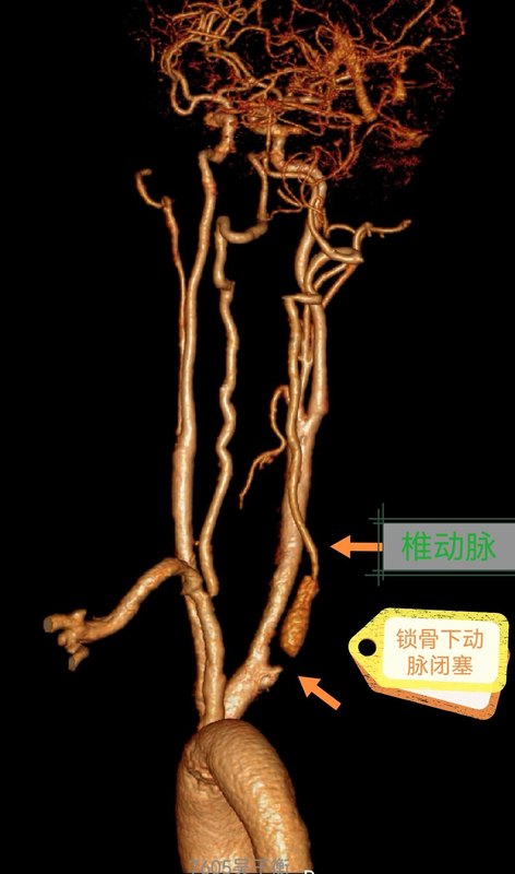 圖文圖片