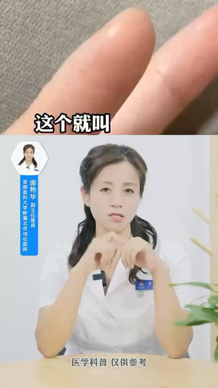 手上长水泡奇痒无比 别抓 这样处理