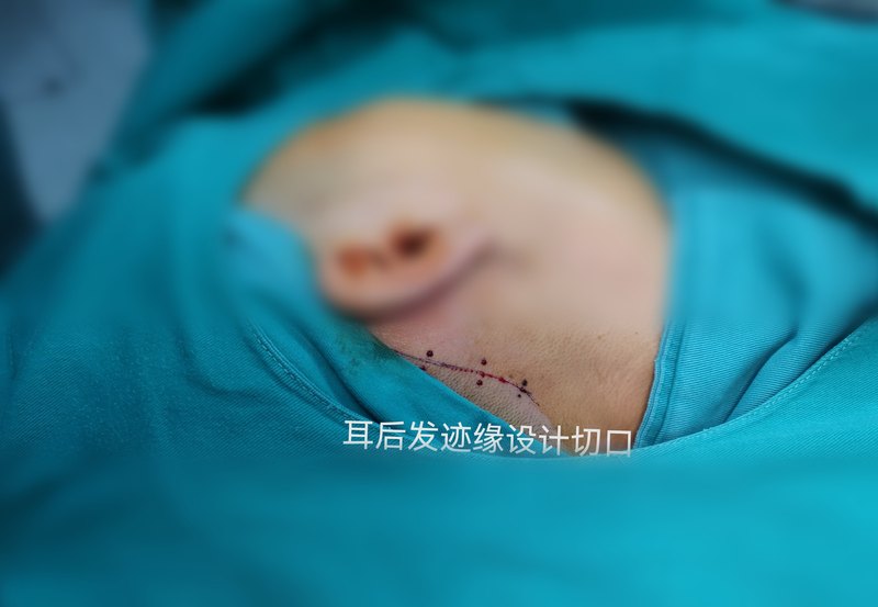 圖文圖片
