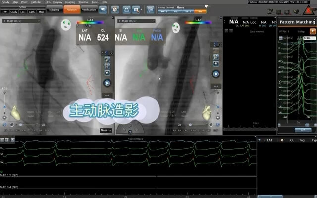我们团队治疗儿童心律失常专业技术一流