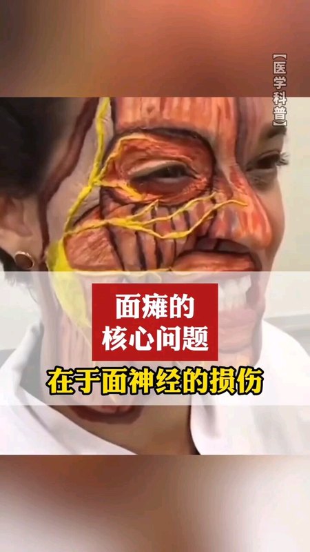 視頻封面