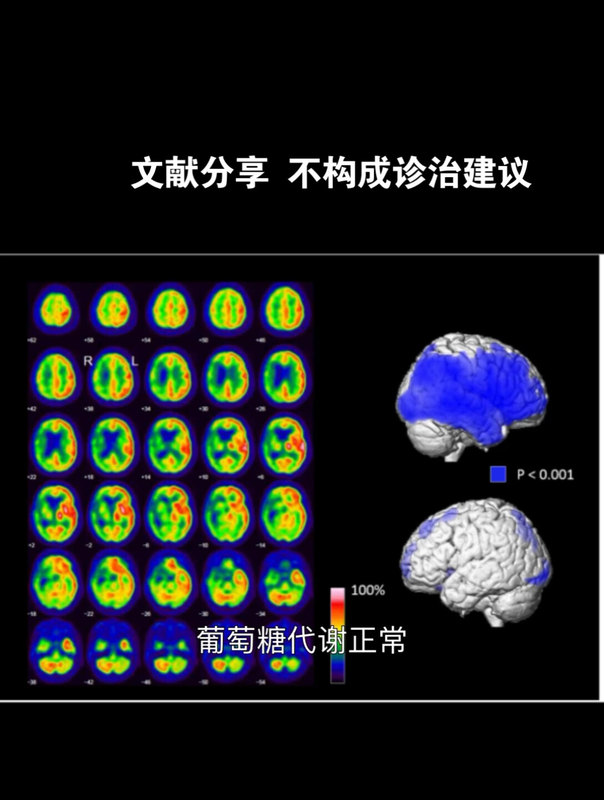 視頻封面