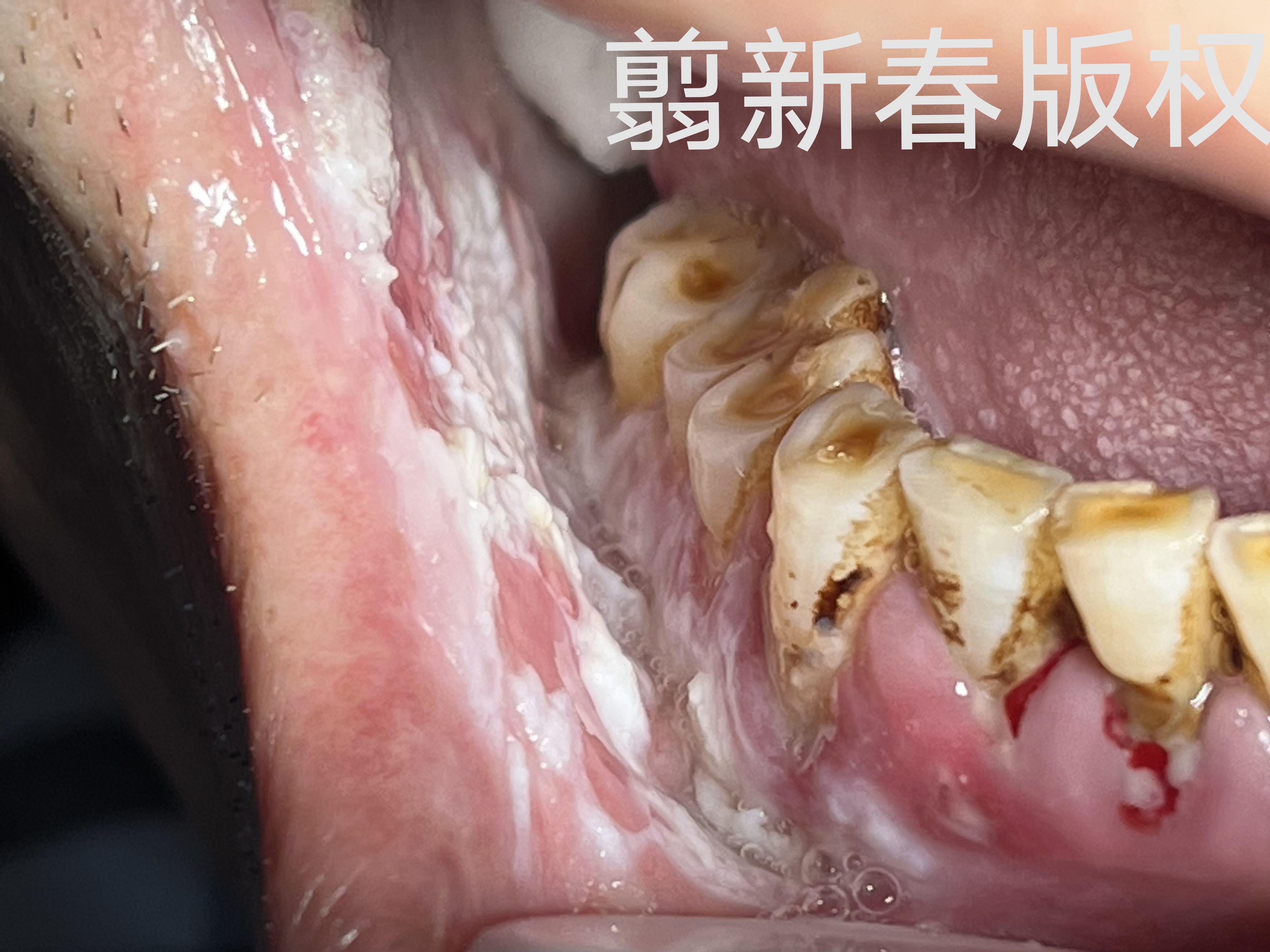 圖文圖片