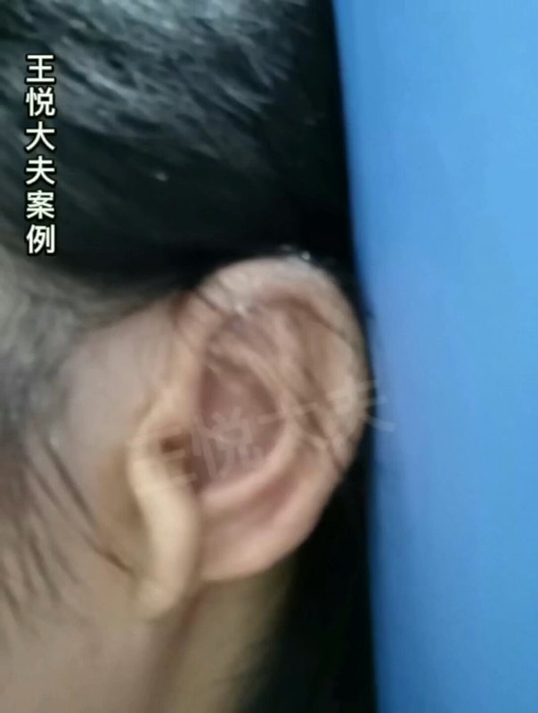 全包法案例分享