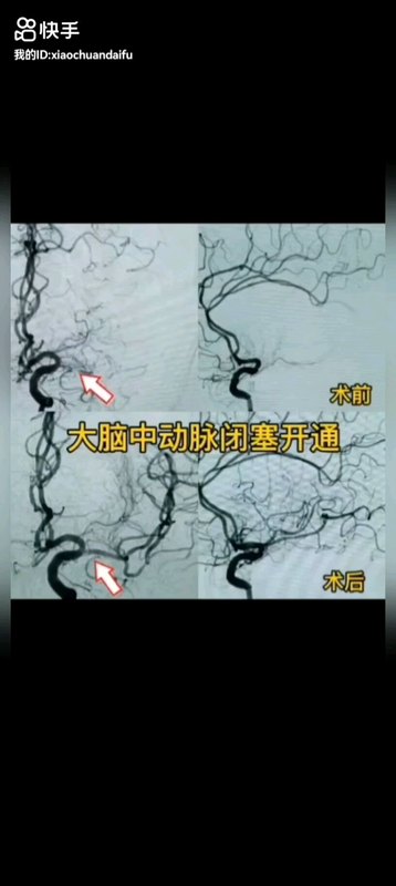 視頻封面