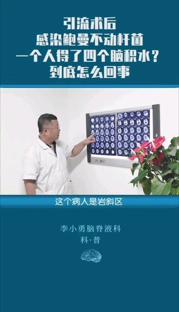 引流术后感染鲍曼不动杆菌，一个人得了四个脑积水？到底怎么回事？