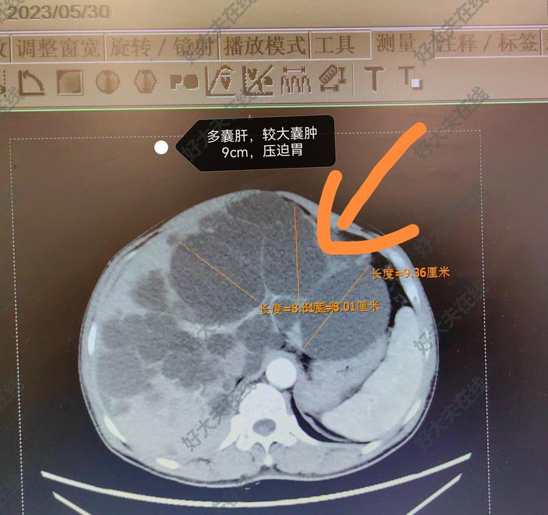 圖文圖片