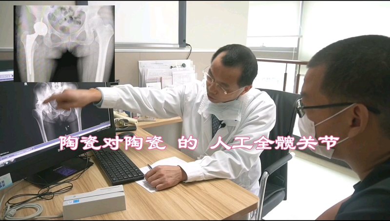 陶瓷对陶瓷的人工全髋关节
