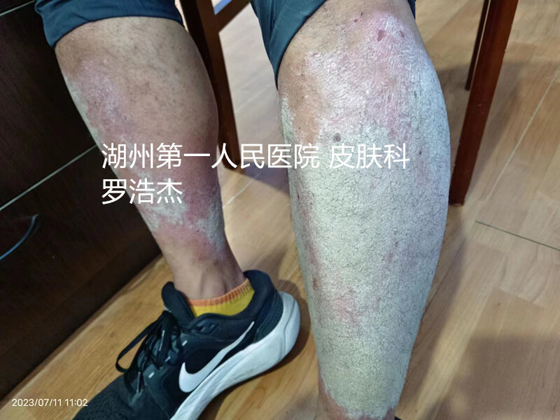 圖文圖片