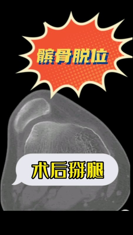 視頻封面