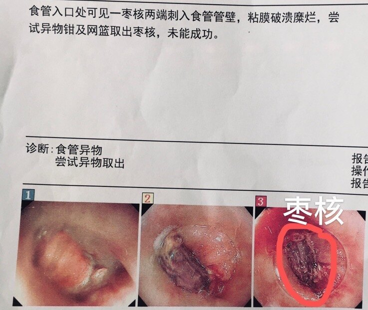 圖文圖片