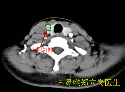 圖文圖片