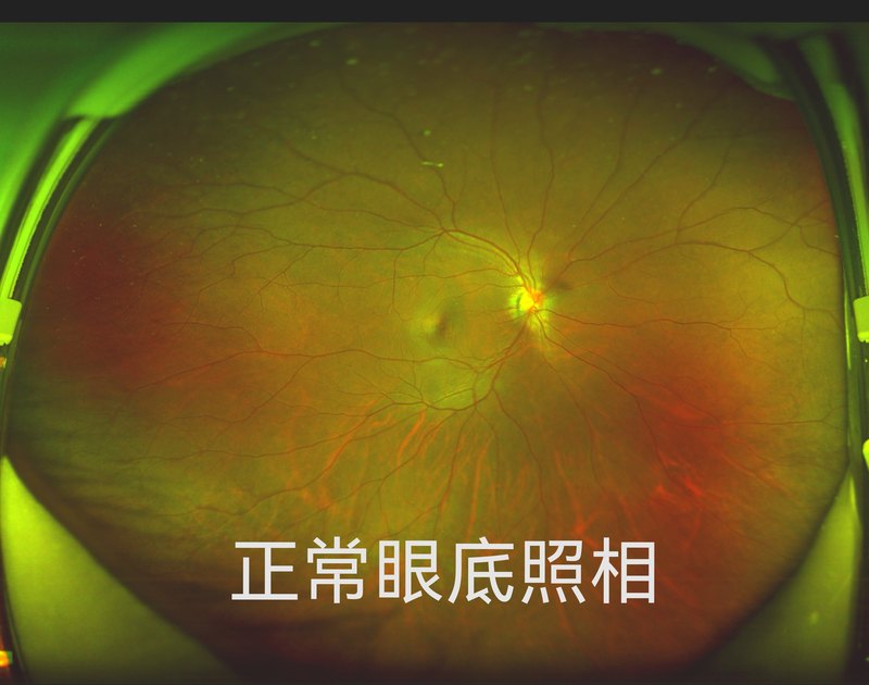 圖文圖片