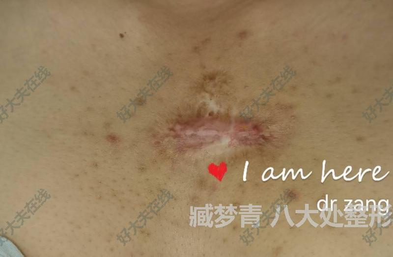 圖文圖片
