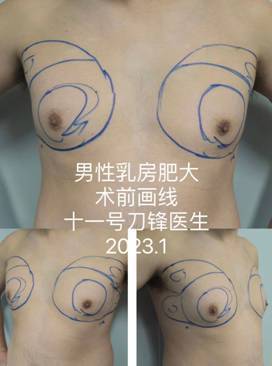 圖文圖片