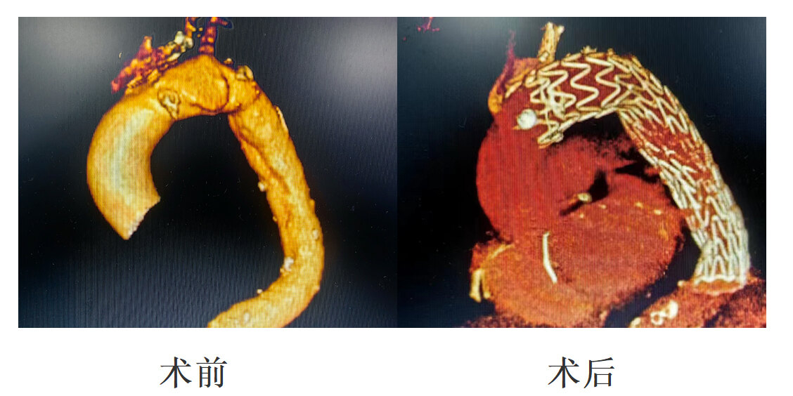 圖文圖片