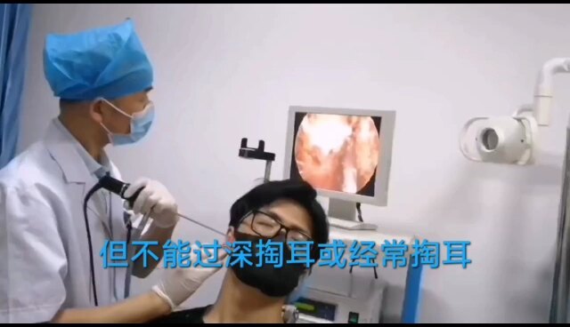 耵聍栓塞处理