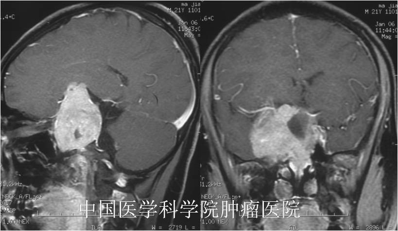 圖文圖片