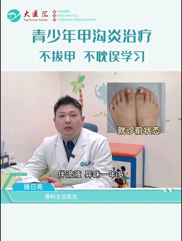 不拔甲不手术不打针不吃药治疗青少年甲沟炎