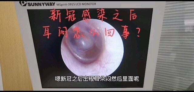 視頻封面