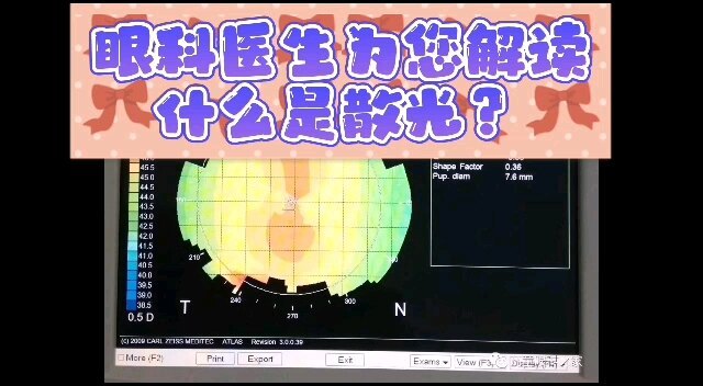 眼科医生为您解读什么是散光？