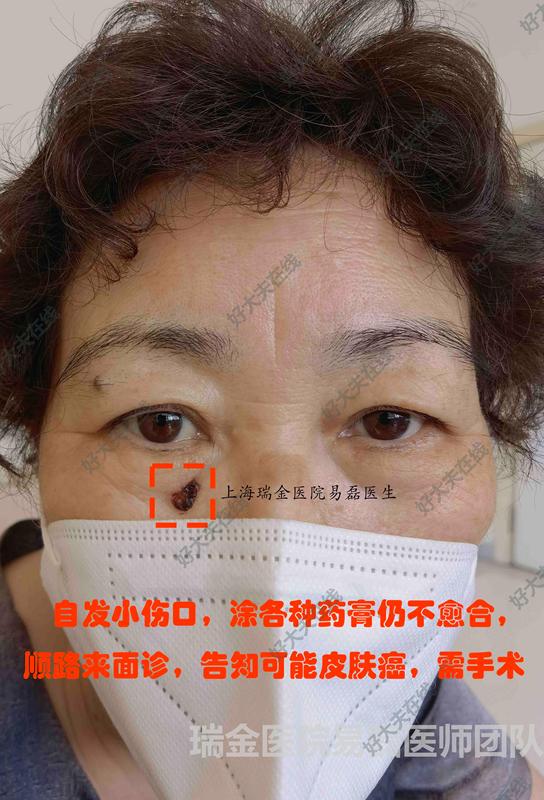 圖文圖片